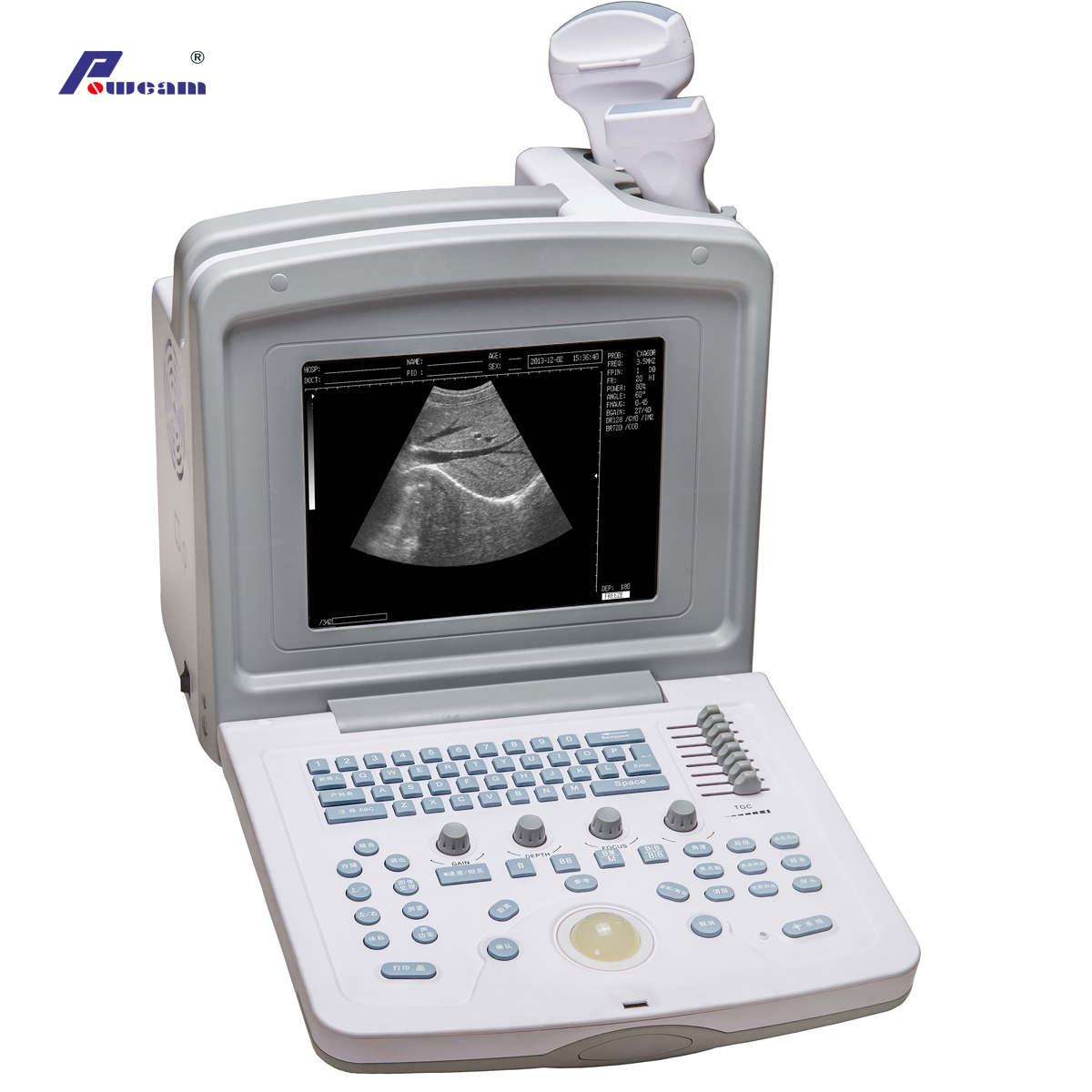 Ce Approved Portable Full Digital Ultrasound (WHYC30P)