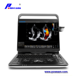 Chison Ebit60 Portable Color Doppler Ultrasound Scanner for Cardiac 
