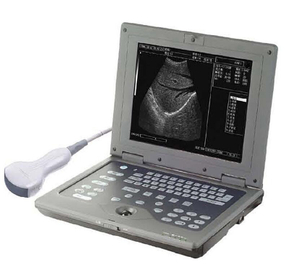  Medical Ultrasound Instruments Laptop Ultrasound Machine B/W Portable Digital Ultrasound Scanner